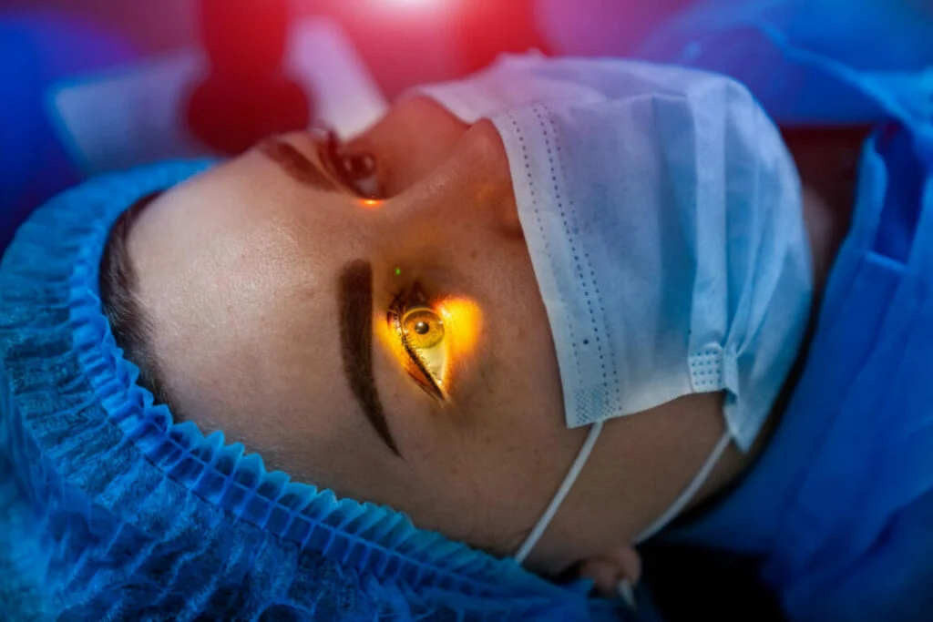 Imagem de uma cirurgia refrativa a LASER.